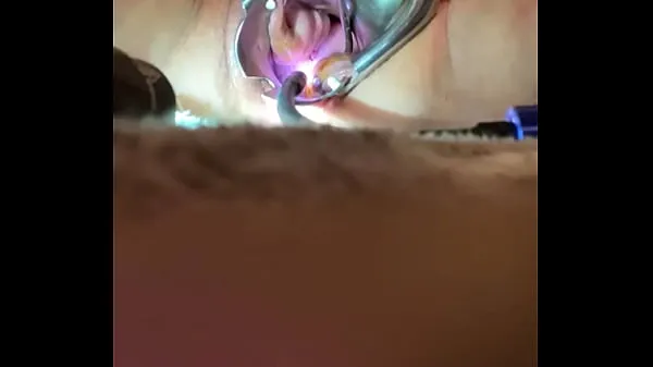 最佳 Internal view of Orgasm w sound tenaculum and vibrator 超级剪辑